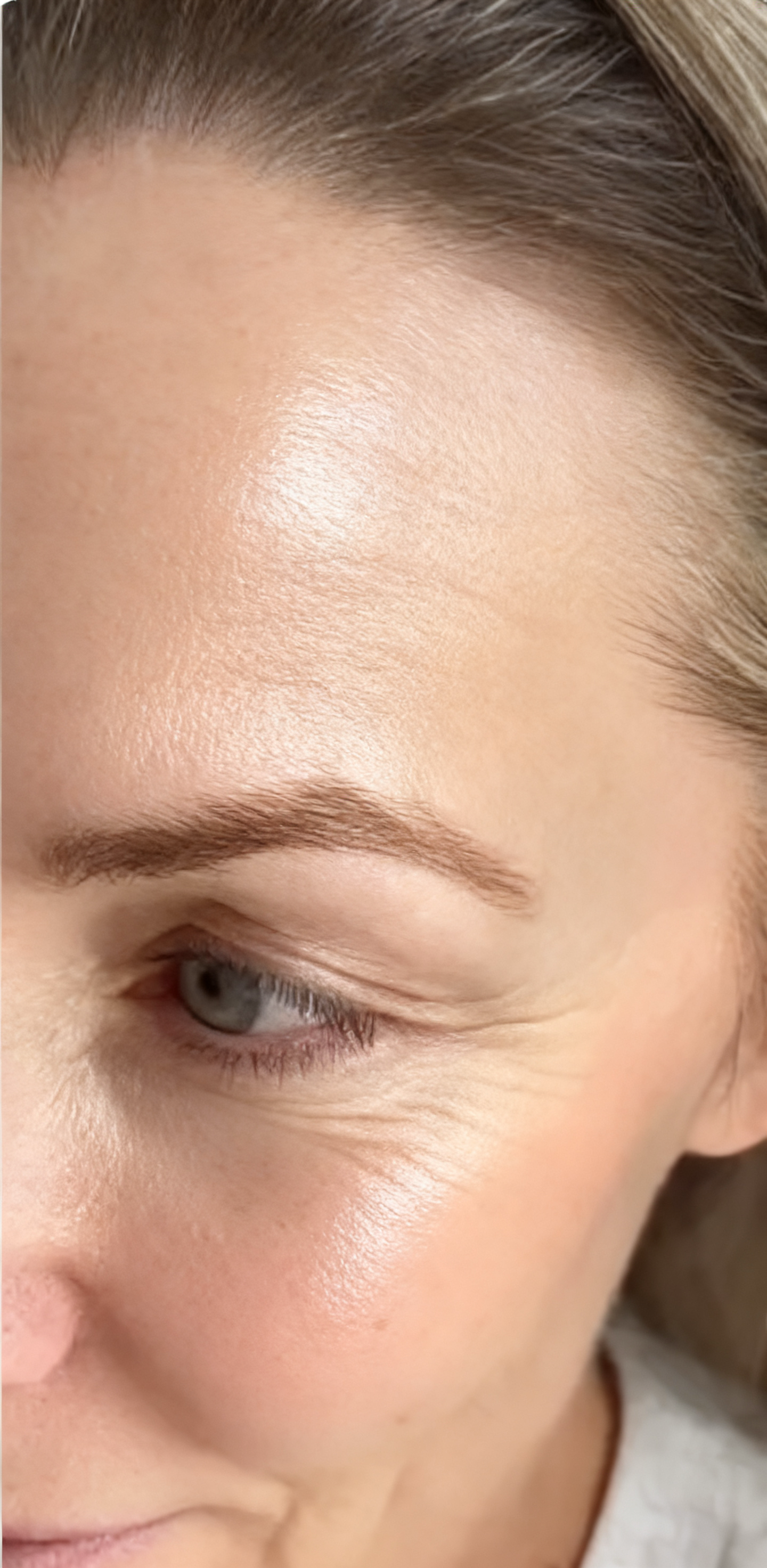 Peau après utilisation du stick SEOYA La Retouche — plus lisse et repulpée (image retouchée)