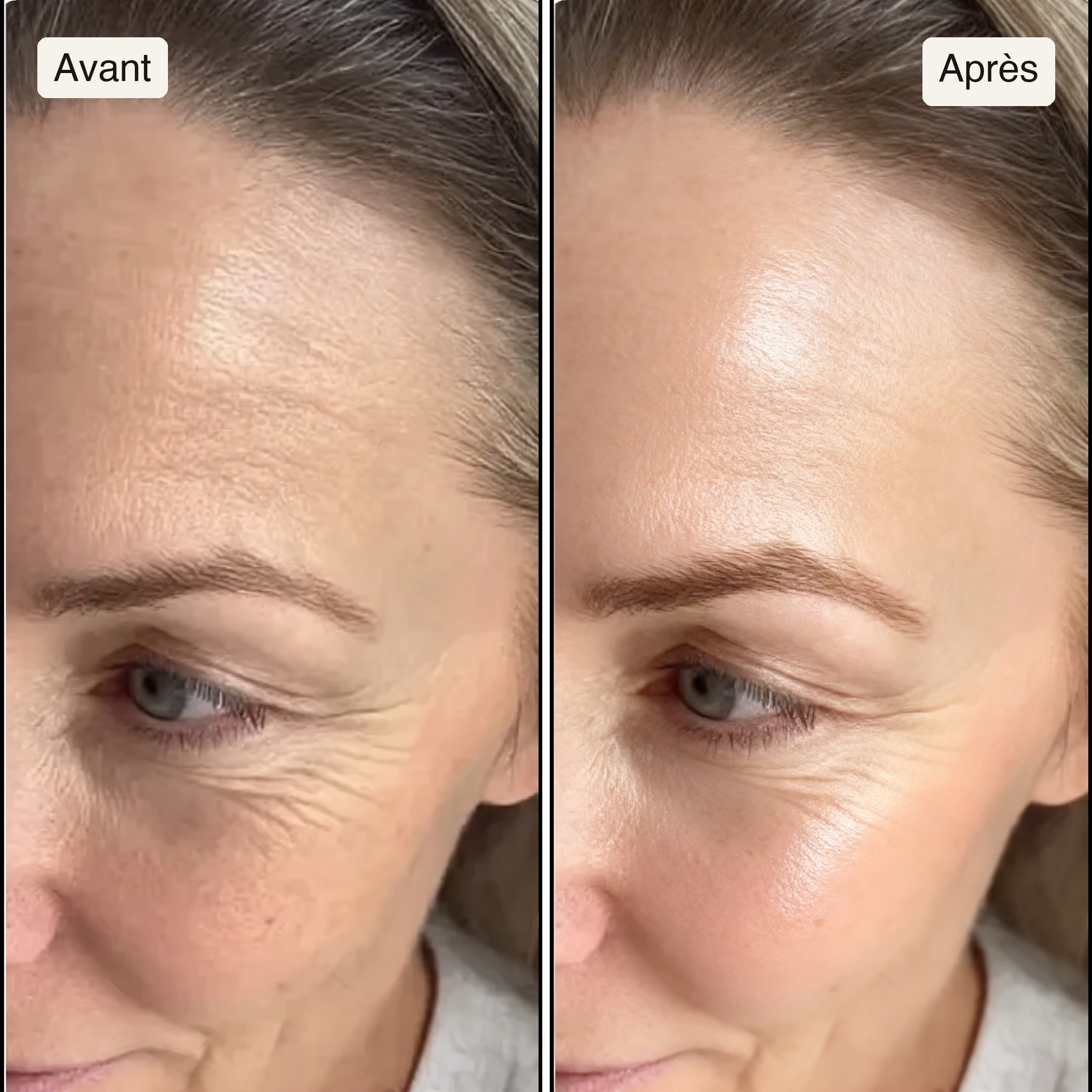 Avant / Après — contour de l'œil, même cadrage, même lumière
