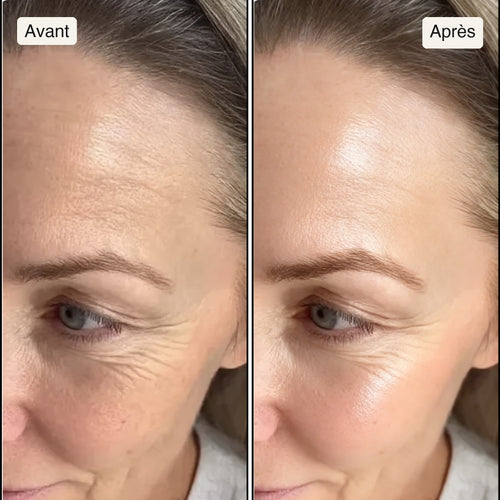Avant / Après — contour de l'œil, même cadrage, même lumière